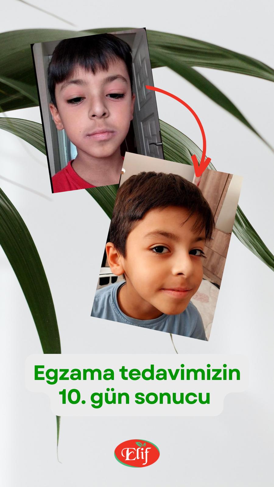 Ürün